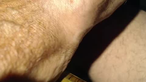 injections online show from July 6, 10:45 am